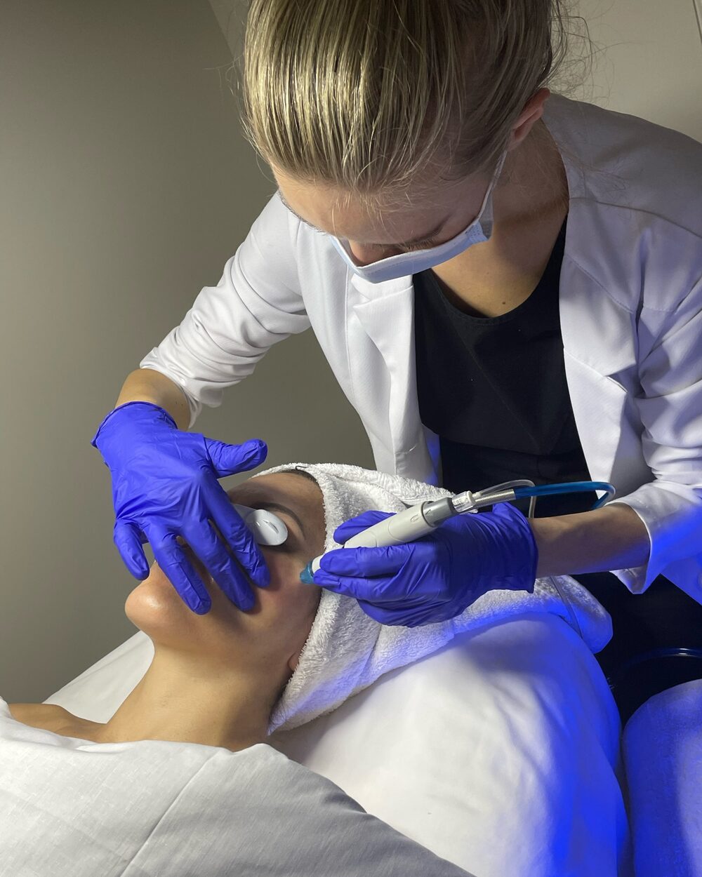 Laser Hair Removal