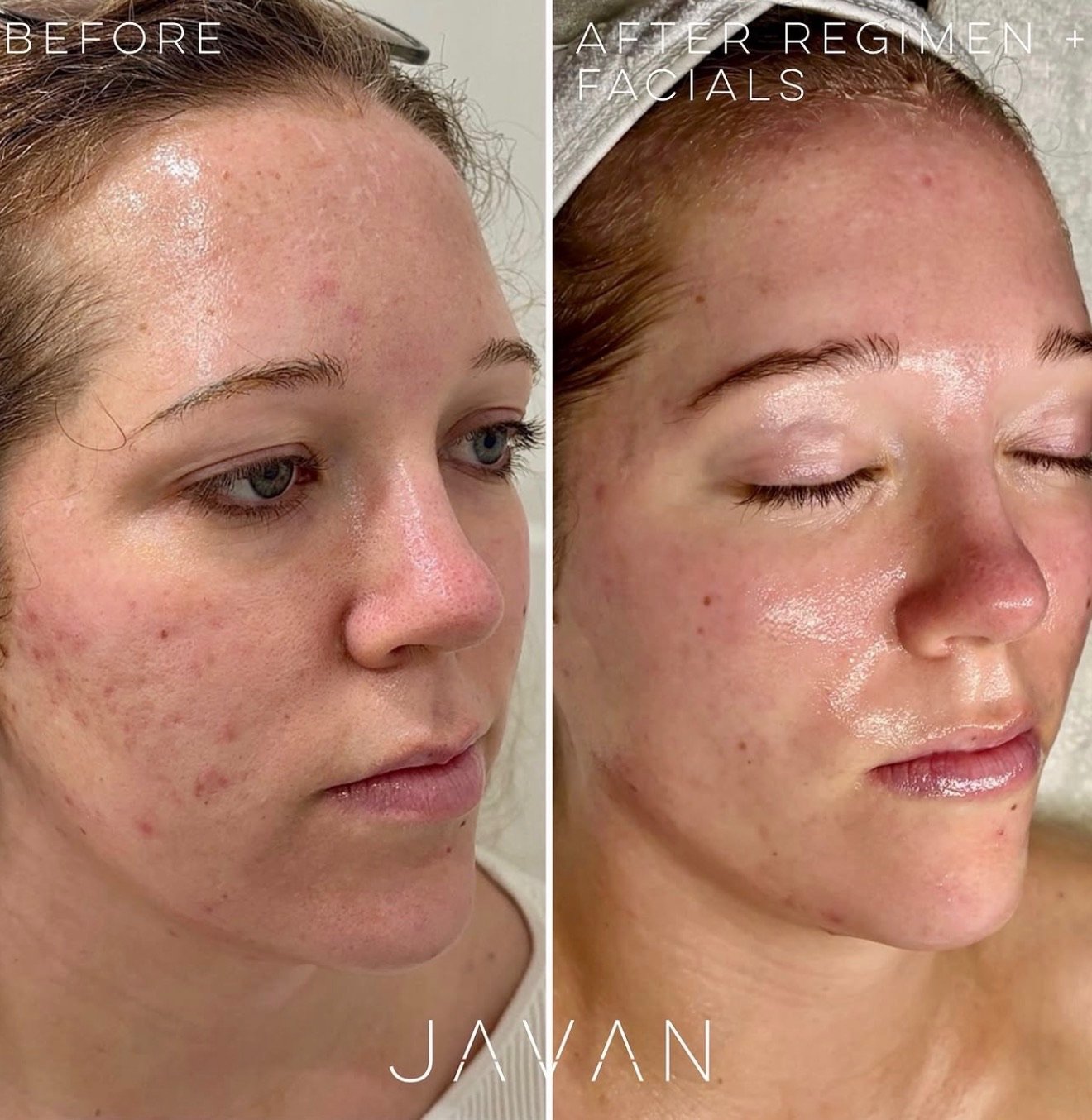 Javan's Signature Facials