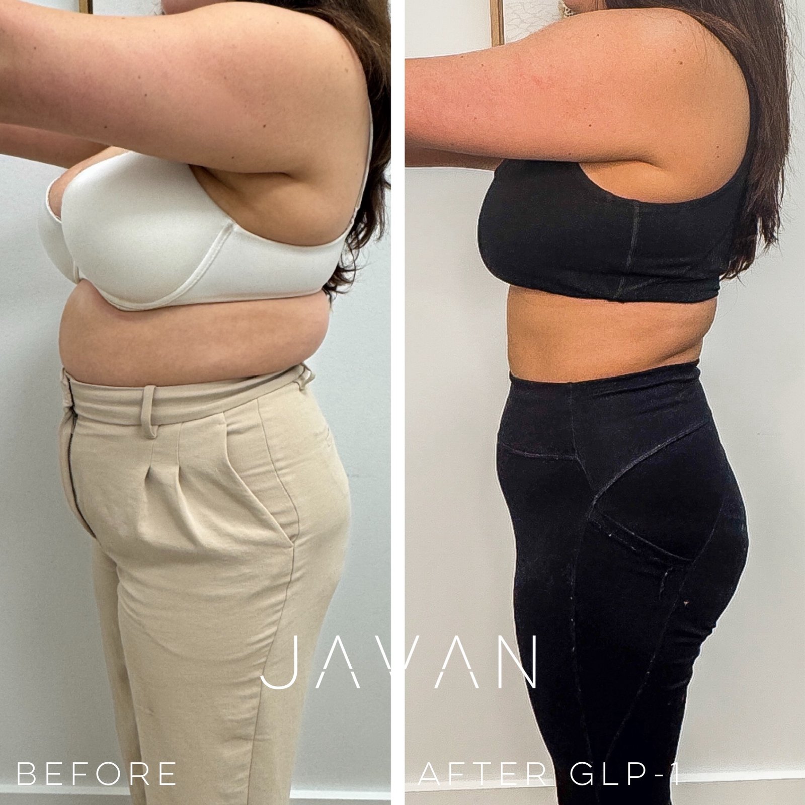 Medical Weight Loss